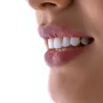 Carillas dentales en Panamá: cuándo sí y cuándo no