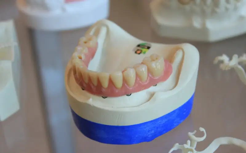 Dentures or Implants: What Changes and When an Overdenture Fits Dentures or Implants: What Changes and When an Overdenture Fits