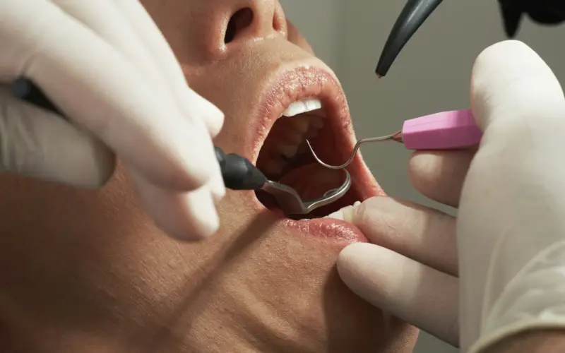Receding Gums: Causes and When a Graft Is Needed Receding Gums: Causes and When a Graft Is Needed
