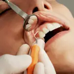 Gingivitis y periodontitis: síntomas, diferencias y tratamiento