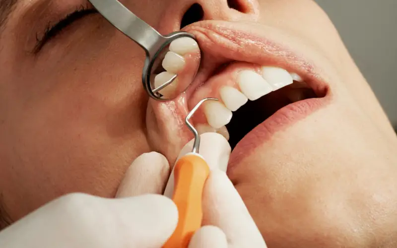 Gingivitis y periodontitis: síntomas, diferencias y tratamiento Gingivitis y periodontitis: síntomas, diferencias y tratamiento